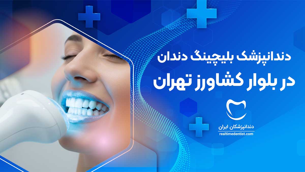بلیچینگ دندان در بلوار کشاورز تهران