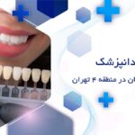 بهترین دکتر کامپوزیت دندان در منطقه 4 تهران