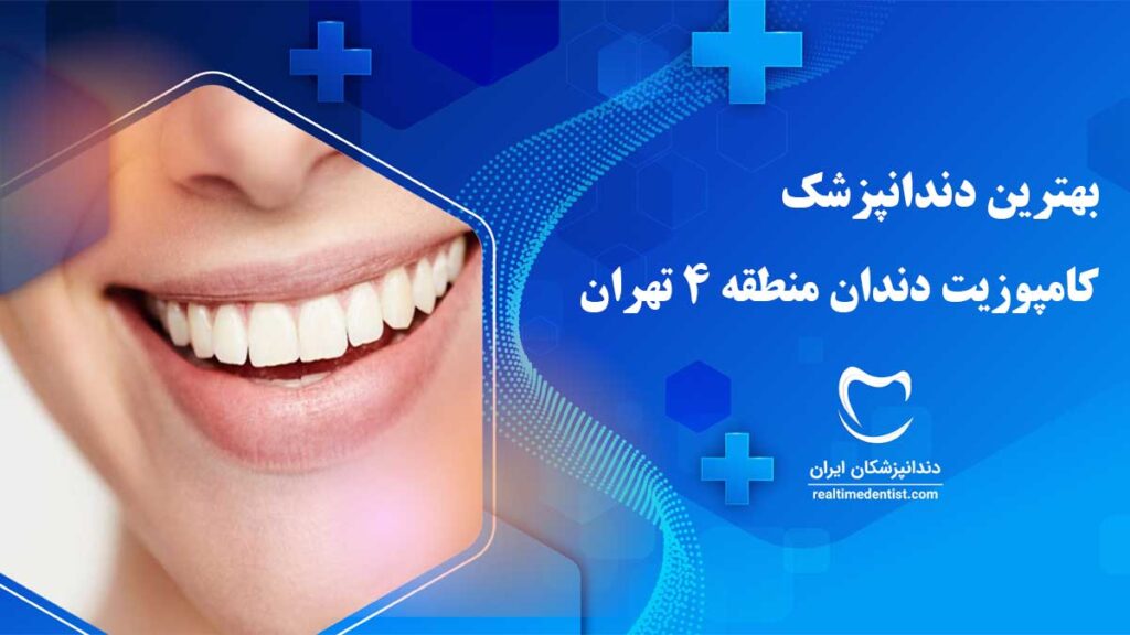 بهترین دکتر کامپوزیت دندان در منطقه 4 تهران