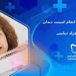 شرایط و نکات انجام لمینت دندان برای دیابتی ها