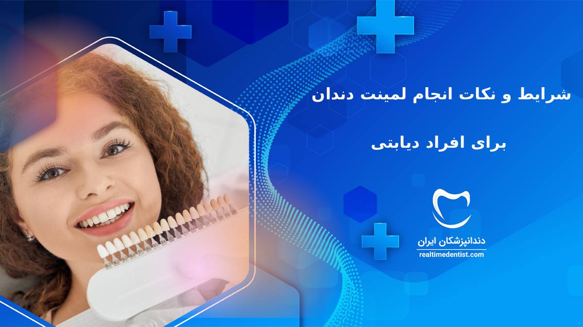 شرایط و نکات انجام لمینت دندان برای دیابتی ها