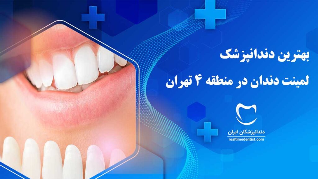بهترین دکتر لمینت دندان در منطقه 4 تهران