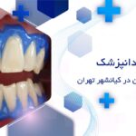 بلیچینگ دندان در کیانشهر تهران