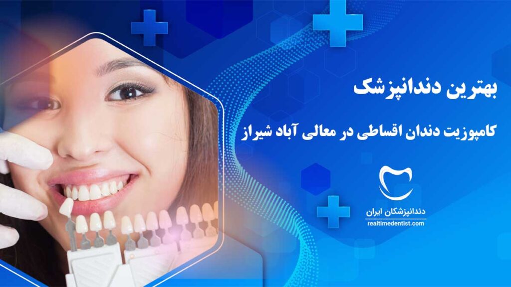 کامپوزیت اقساطی در معالی آباد شیراز