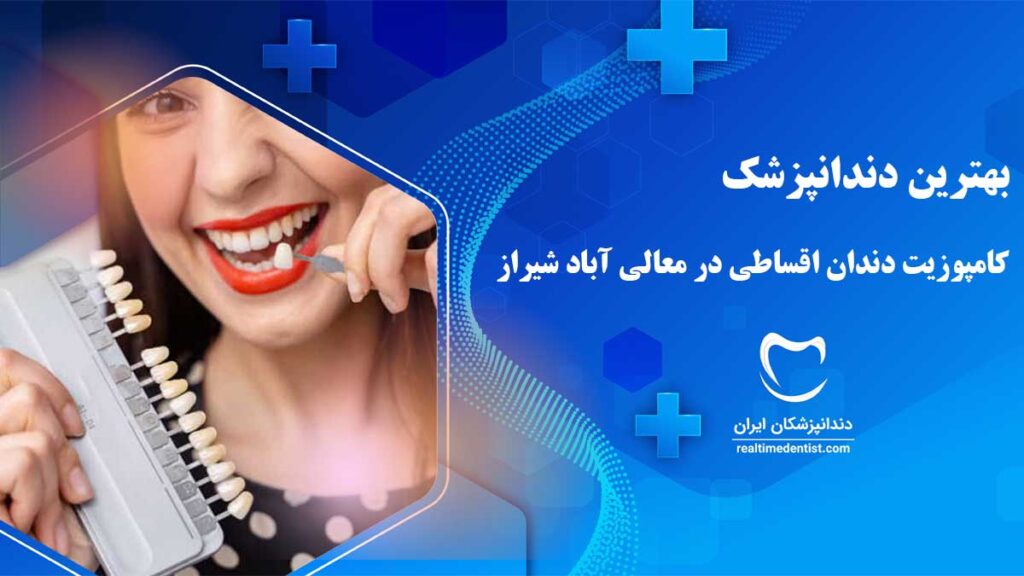 لمینت اقساطی در معالی آباد شیراز