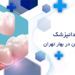 روکش دندان در بهار تهران