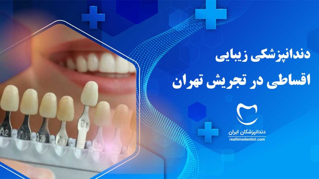 دندانپزشکی زیبایی اقساطی در تجریش تهران