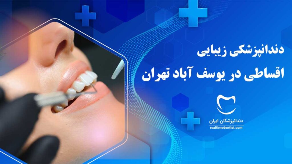 دندانپزشکی زیبایی اقساطی در یوسف آباد تهران