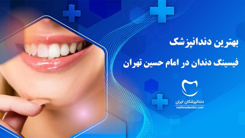 فیسینگ دندان در امام حسین تهران