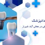 ایمپلنت اقساطی در معالی آباد شیراز