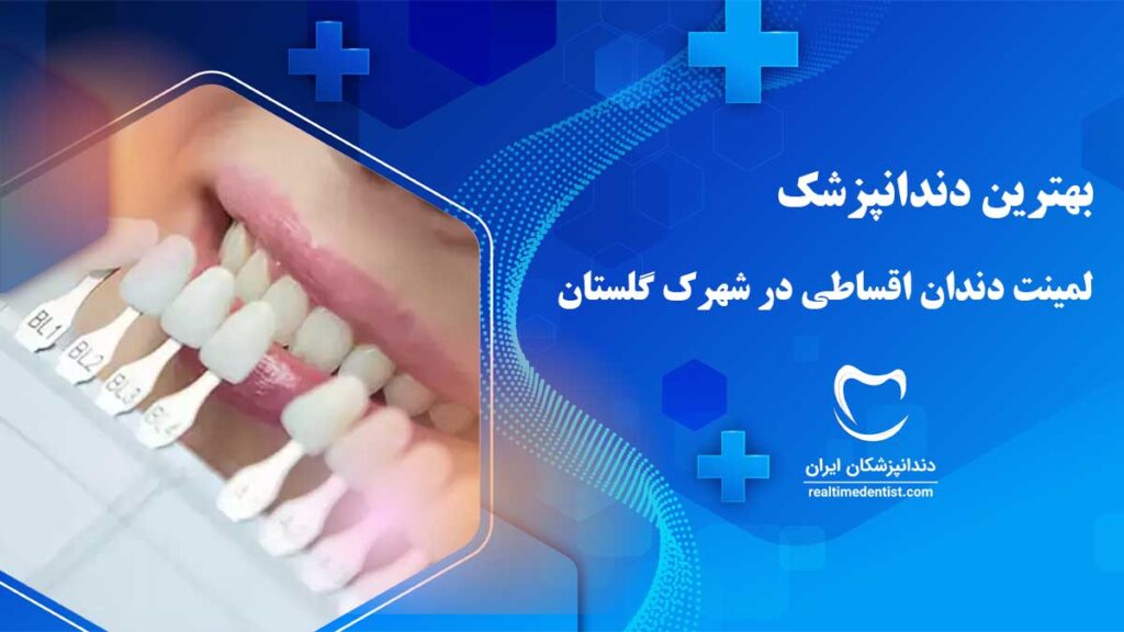 لمینت اقساطی در شهرک گلستان شیراز