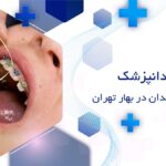 ارتودنسی دندان در بهار تهران