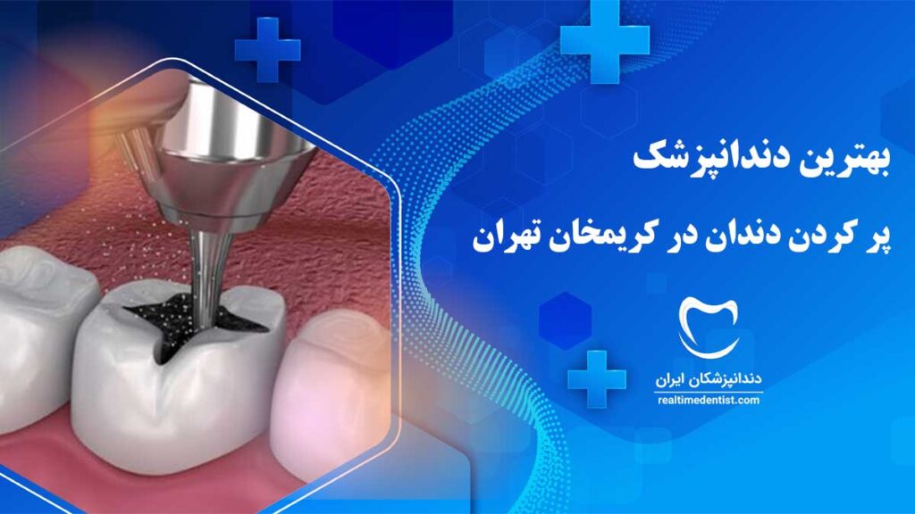 پر کردن دندان در کریمخان تهران