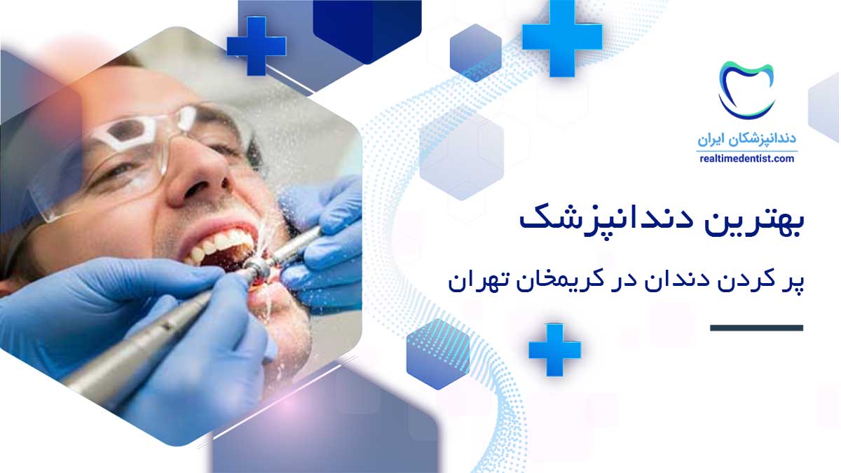 پر کردن دندان در کریمخان تهران