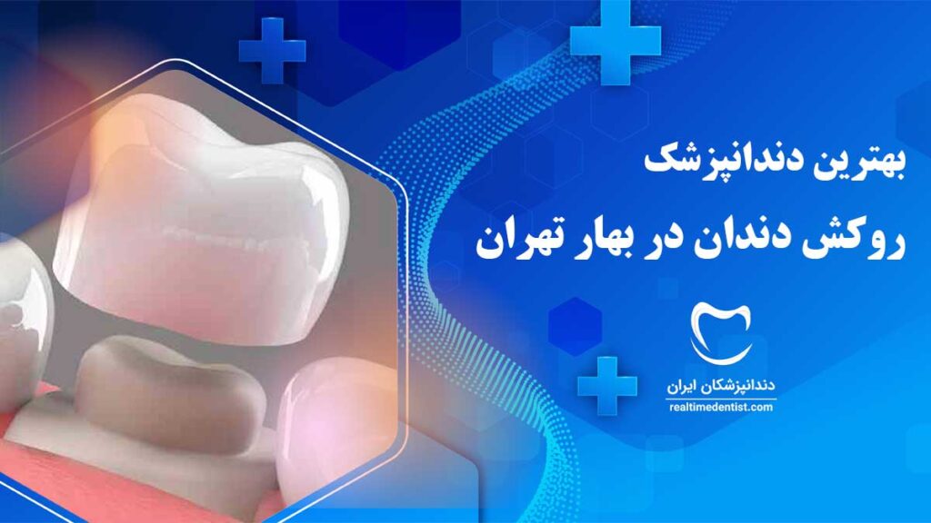 روکش دندان در بهار تهران