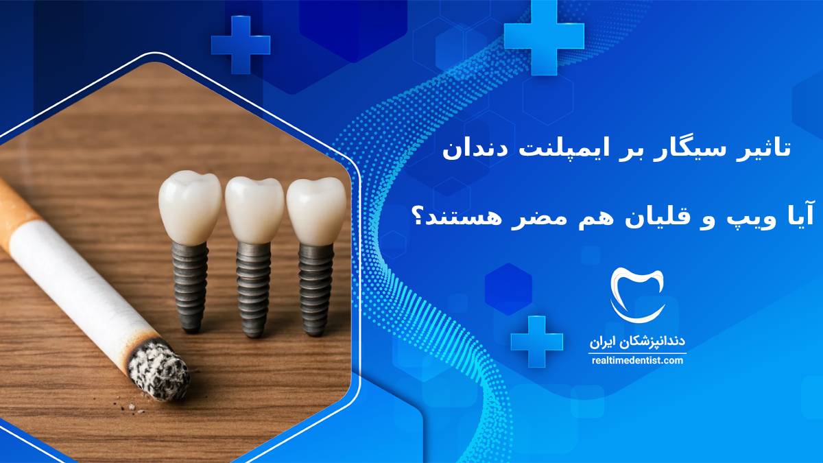تاثیر سیگار بر ایمپلنت دندان | آیا ویپ و قلیان هم مضر هستند؟