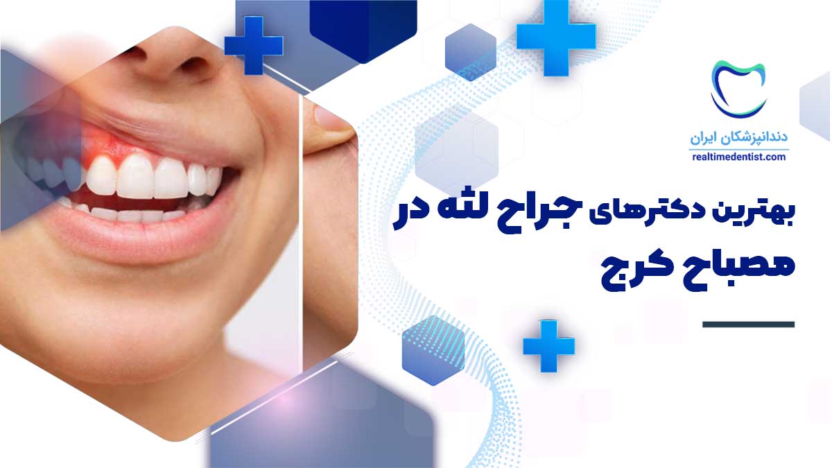 جراحی لثه در مصباح کرج