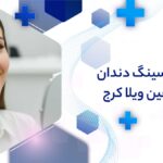 فیسینگ دندان در شاهین ویلا کرج