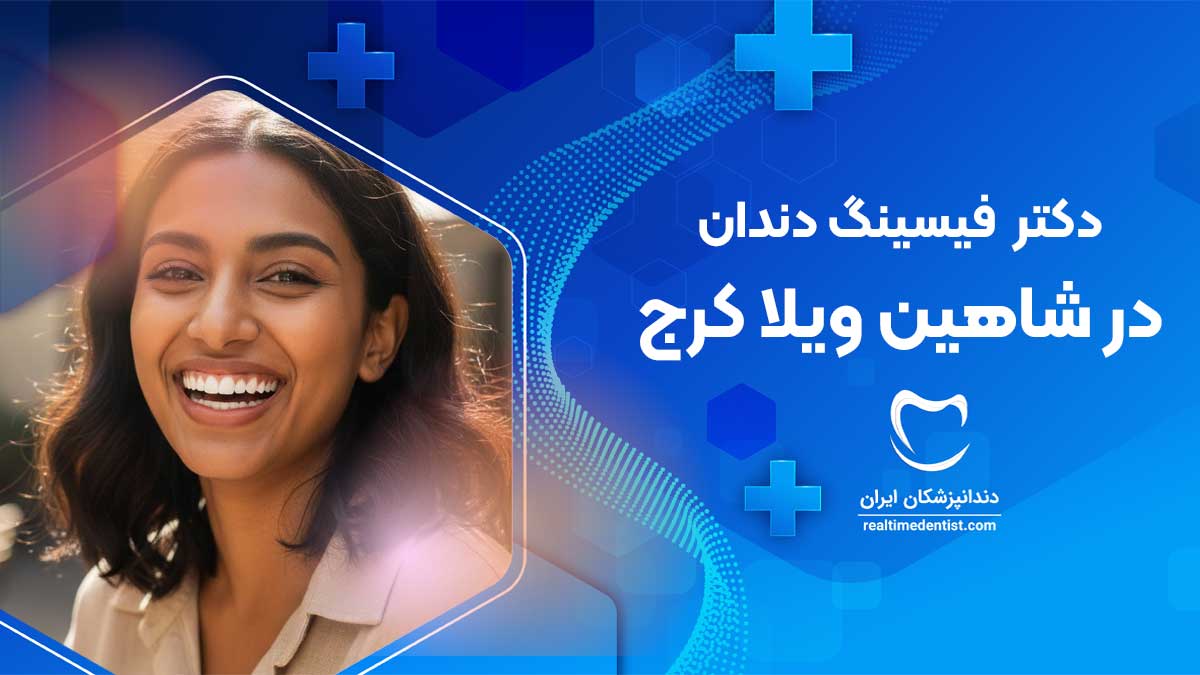 فیسینگ دندان در شاهین ویلا کرج