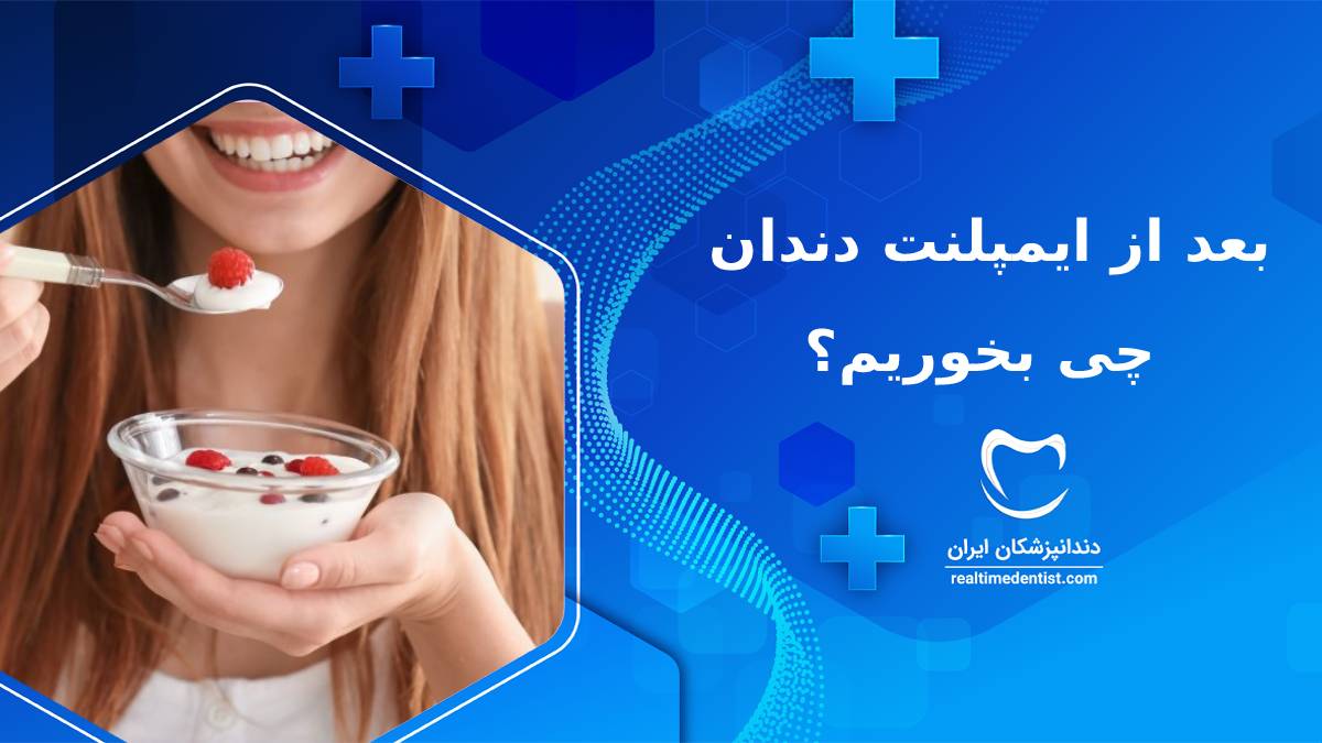 بعد از ایمپلنت چی بخوریم؟ | غذا خوردن بعد از ایمپلنت