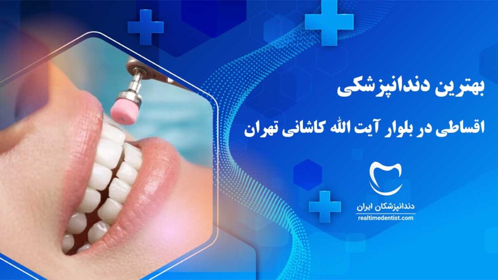 خدمات دندانپزشکی اقساطی در آیت الله کاشانی تهران