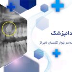 جراحی دندان نهفته در بلوار گلستان شیراز