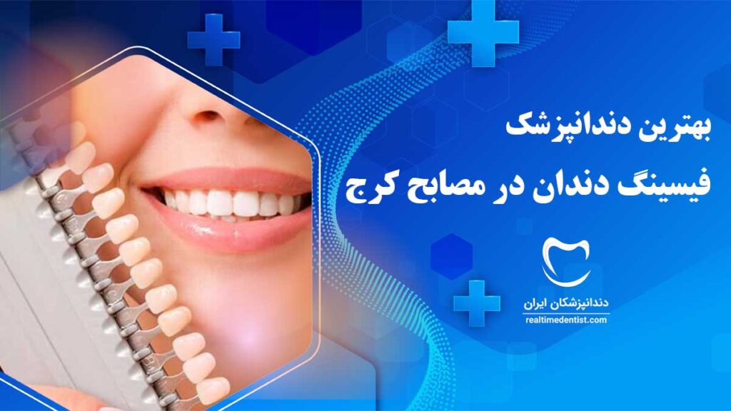 فیسینگ دندان در مصباح کرج