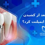 چه مدت بعد از کشیدن دندان باید ایمپلنت کرد؟
