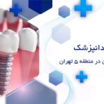 بهترین دکتر ایمپلنت دندان در منطقه 5 تهران