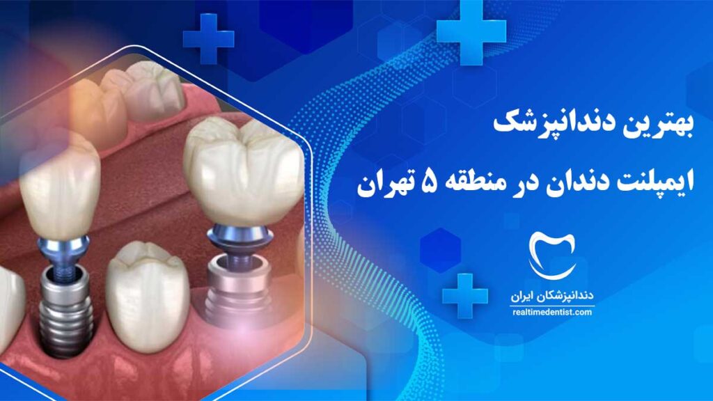 بهترین دکتر ایمپلنت دندان در منطقه 5 تهران