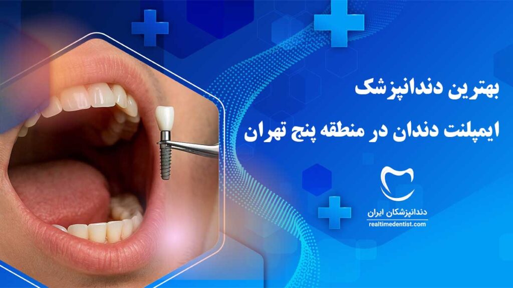 بهترین دکتر ایمپلنت دندان در منطقه 5 تهران