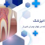 جراحی دندان نهفته در بلوار چمران شیراز