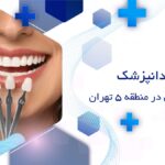 بهترین دکتر لمینت دندان در منطقه 5 تهران