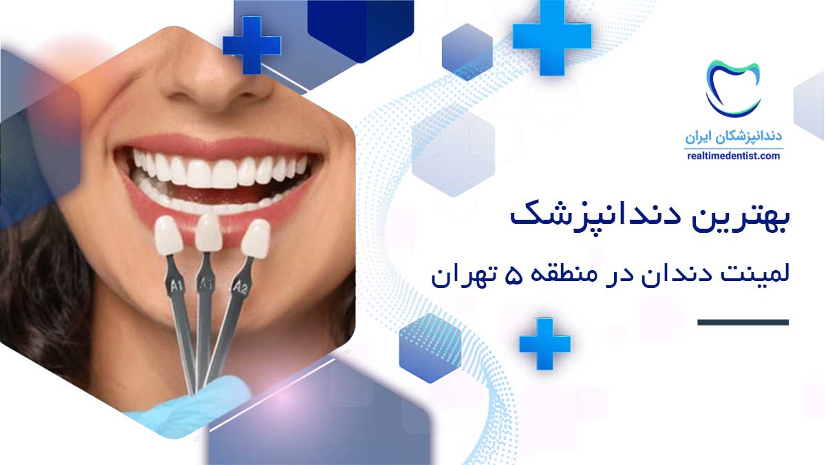 بهترین دکتر لمینت دندان در منطقه 5 تهران