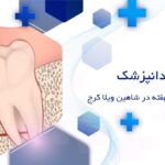 جراحی دندان نهفته در شاهین ویلا کرج