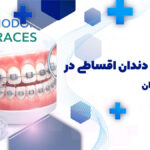 ارتودنسی دندان اقساطی در هروی تهران