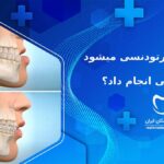 آیا با دندان ارتودنسی میشود عمل بینی انجام داد؟