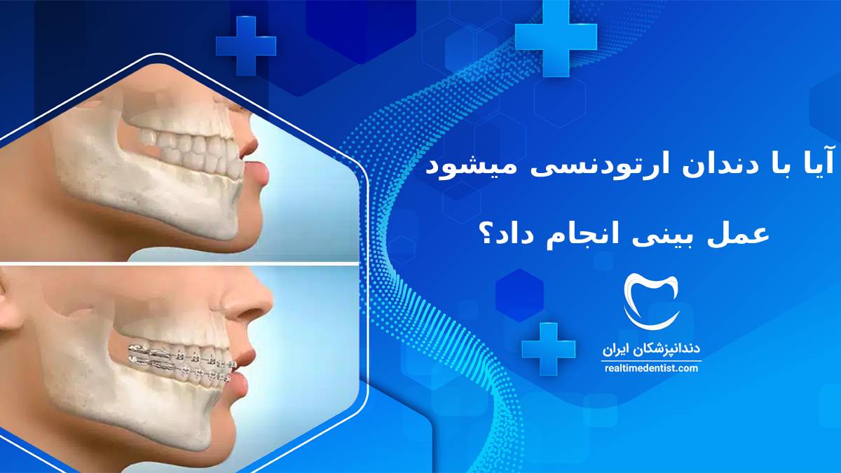 آیا با دندان ارتودنسی میشود عمل بینی انجام داد؟