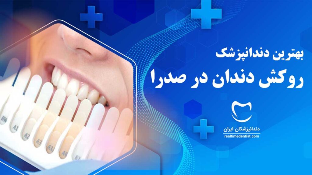 روکش دندان در صدرا