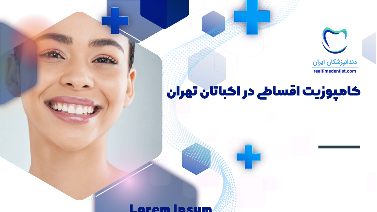 دکتر کامپوزیت اقساطی در اکباتان تهران + نحوه پیش پرداخت و پرداخت قسط با چک یا سفته