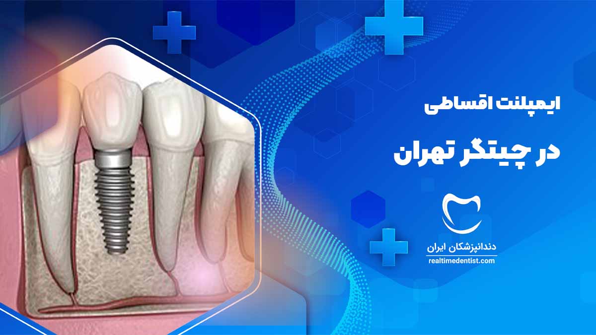 ایمپلنت اقساطی در چیتگر تهران