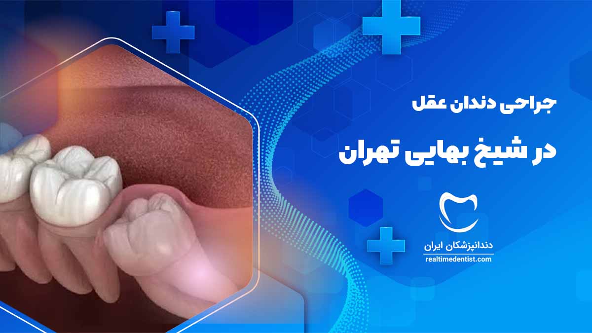 جراحی دندان عقل در شیراز 