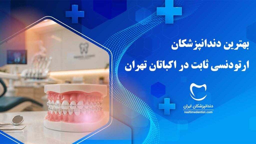ارتودنسی ثابت در اکباتان تهران