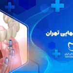 پروتز دندان در شیخ بهایی تهران