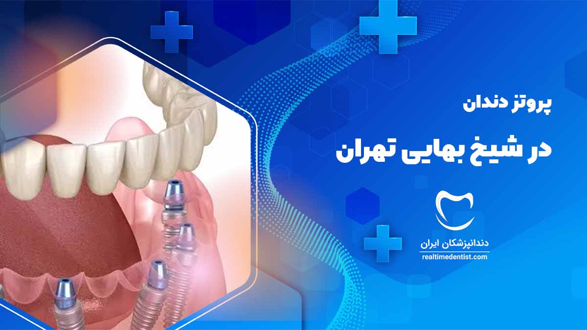 پروتز دندان در شیخ بهایی تهران