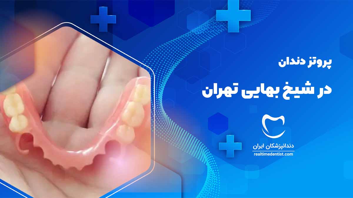 پروتز دندان در شیخ بهایی تهران 