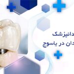 بهترین دکترهای روکش دندان در یاسوج