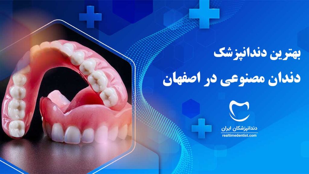 دندان مصنوعی در اصفهان