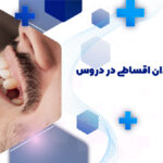 بهترین دکتر ایمپلنت دندان اقساطی در دروس تهران