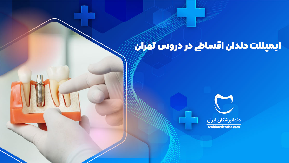 بهترین دکتر ایمپلنت دندان اقساطی در دروس تهران